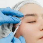 5 medical benefits of botox