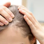 Hair Thinning Vs Hair Shedding