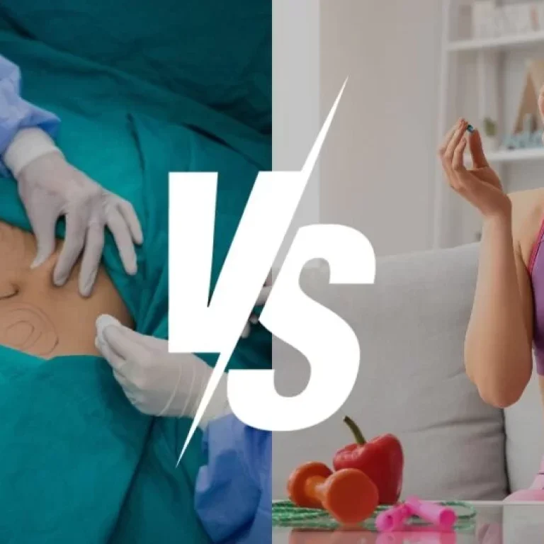 Traditional Method vs Medical weight Loss